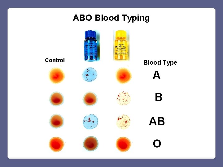 ABO Blood Typing Control Blood Type A B AB O 