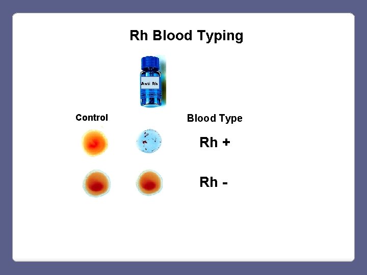 Rh Blood Typing Anti Rh Control Blood Type Rh + Rh - 