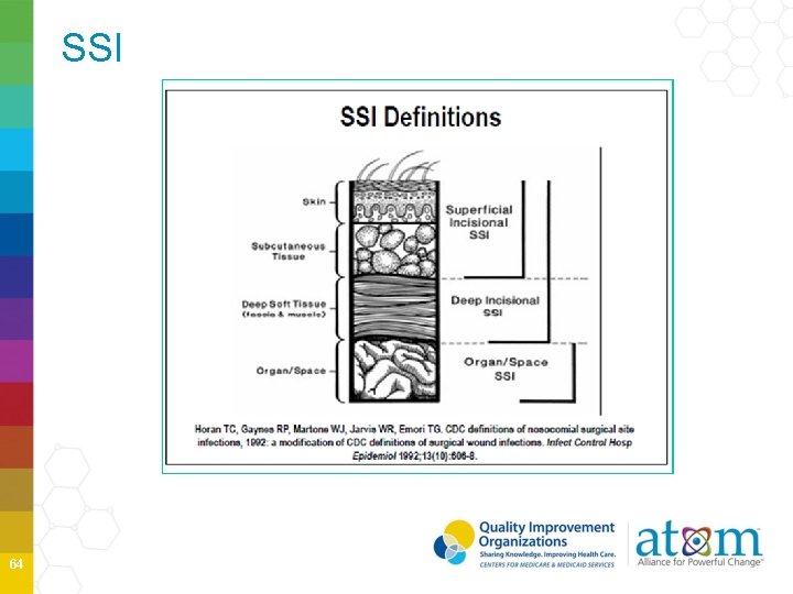 SSI 64 