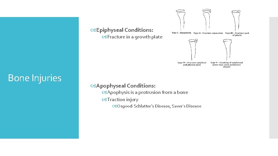  Epiphyseal Conditions: Fracture in a growth plate Bone Injuries Apophyseal Conditions: Apophysis is