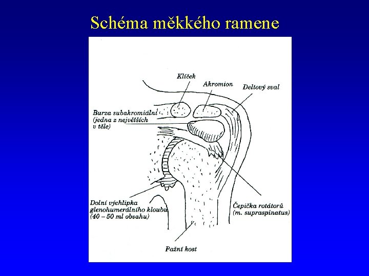 Schéma měkkého ramene 