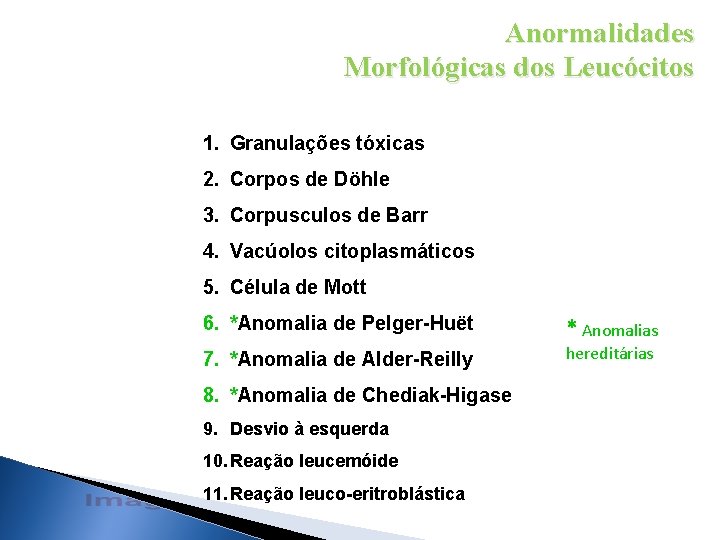 Anormalidades Morfológicas dos Leucócitos 1. Granulações tóxicas 2. Corpos de Döhle 3. Corpusculos de Anormalidades Morfológicas dos Leucócitos 1. Granulações tóxicas 2. Corpos de Döhle 3. Corpusculos de