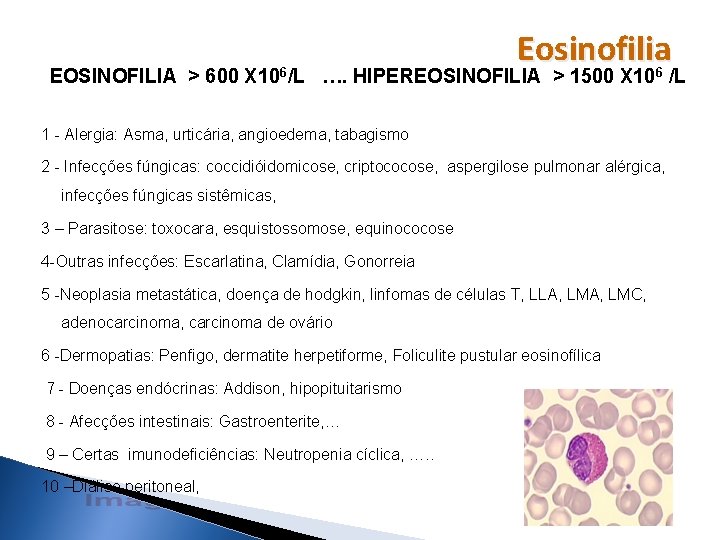 Eosinofilia EOSINOFILIA > 600 X 106/L …. HIPEREOSINOFILIA > 1500 X 106 /L 1 Eosinofilia EOSINOFILIA > 600 X 106/L …. HIPEREOSINOFILIA > 1500 X 106 /L 1