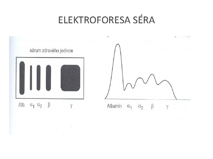 ELEKTROFORESA SÉRA 