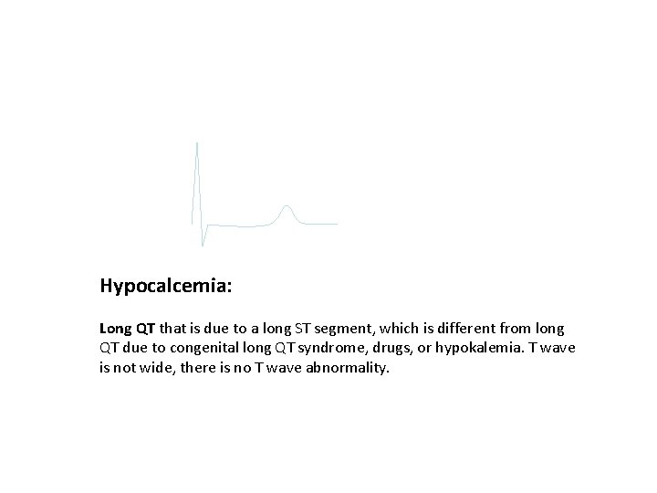 Hypocalcemia: Long QT that is due to a long ST segment, which is different