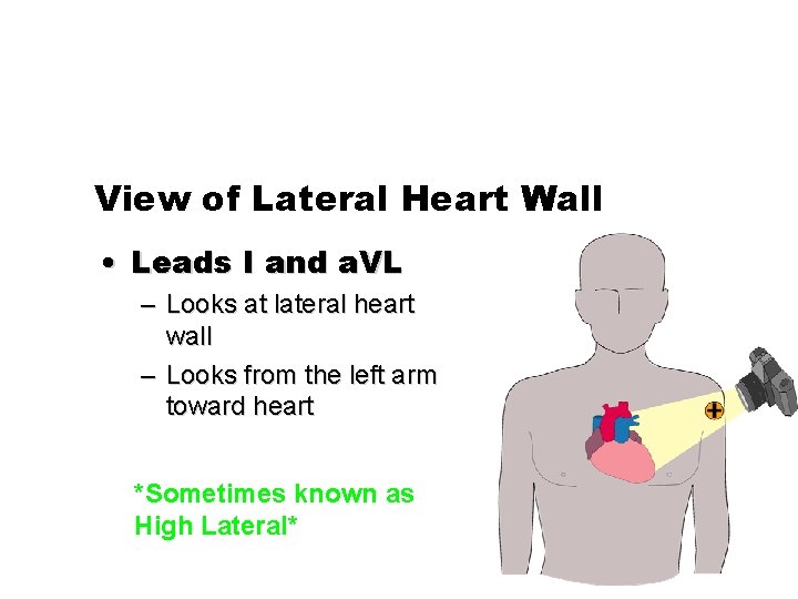 View of Lateral Heart Wall • Leads I and a. VL – Looks at