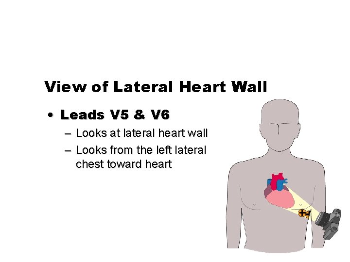 View of Lateral Heart Wall • Leads V 5 & V 6 – Looks