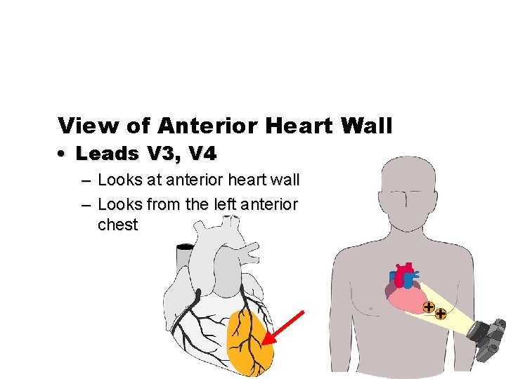 View of Anterior Heart Wall • Leads V 3, V 4 – Looks at