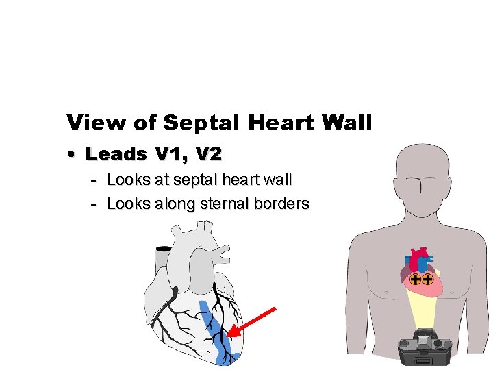 View of Septal Heart Wall • Leads V 1, V 2 - Looks at