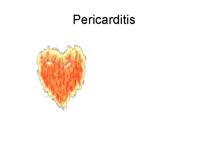 Pericarditis 