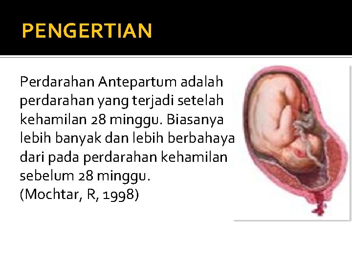 PENGERTIAN Perdarahan Antepartum adalah perdarahan yang terjadi setelah kehamilan 28 minggu. Biasanya lebih banyak