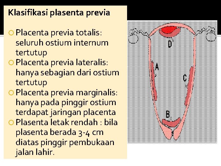 Klasifikasi plasenta previa Placenta previa totalis: seluruh ostium internum tertutup Placenta previa lateralis: hanya