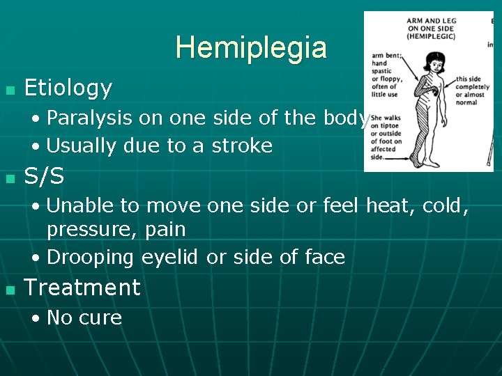 Hemiplegia n Etiology • Paralysis on one side of the body • Usually due