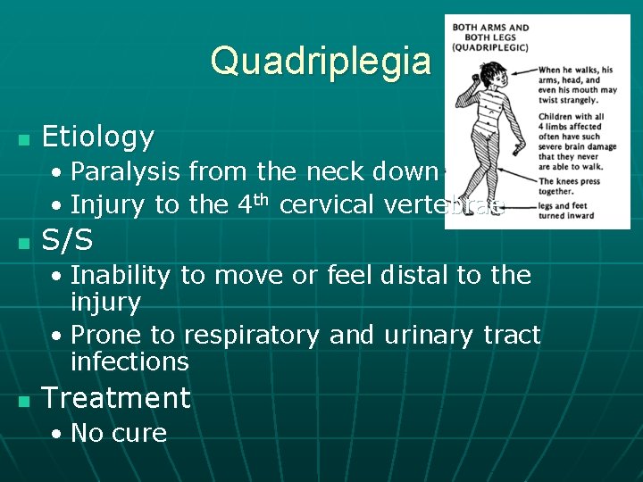 Quadriplegia n Etiology • Paralysis from the neck down • Injury to the 4