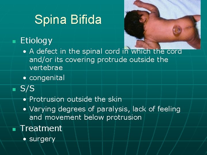 Spina Bifida n Etiology • A defect in the spinal cord in which the