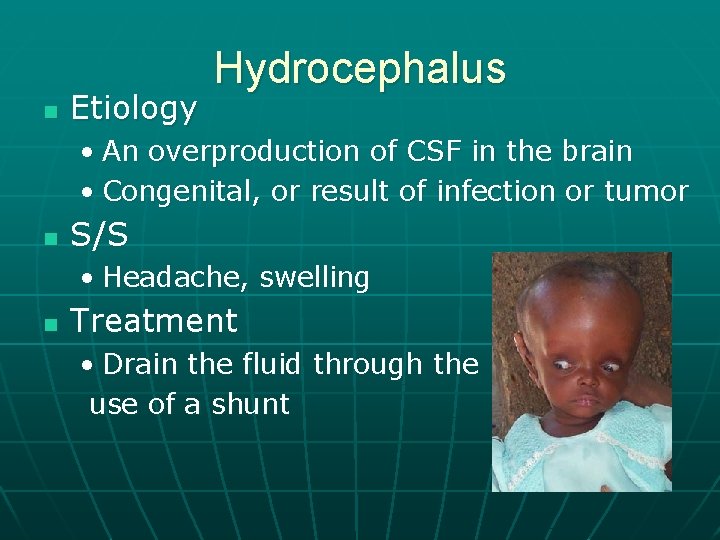 n Etiology Hydrocephalus • An overproduction of CSF in the brain • Congenital, or