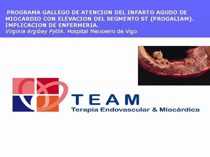 PROGRAMA GALLEGO DE ATENCION DEL INFARTO AGUDO DE MIOCARDIO CON ELEVACION DEL SEGMENTO ST PROGRAMA GALLEGO DE ATENCION DEL INFARTO AGUDO DE MIOCARDIO CON ELEVACION DEL SEGMENTO ST