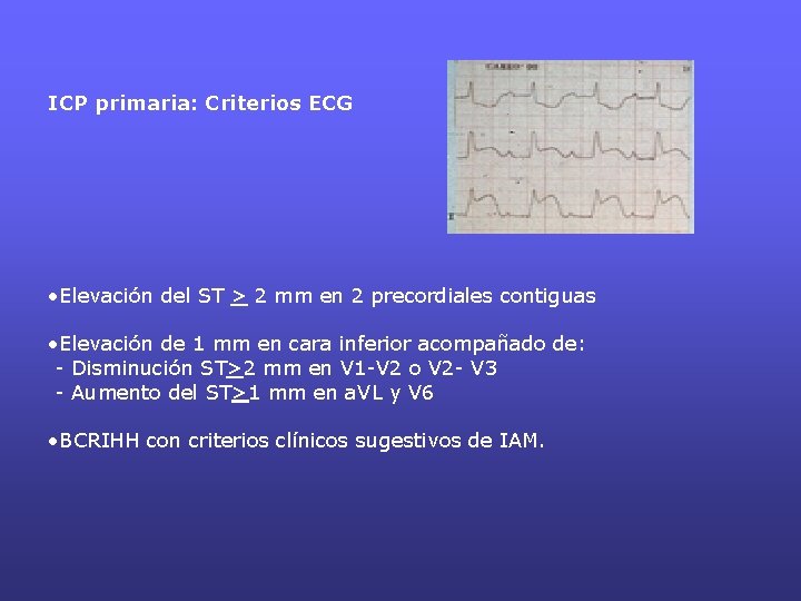 ICP primaria: Criterios ECG • Elevación del ST > 2 mm en 2 precordiales ICP primaria: Criterios ECG • Elevación del ST > 2 mm en 2 precordiales