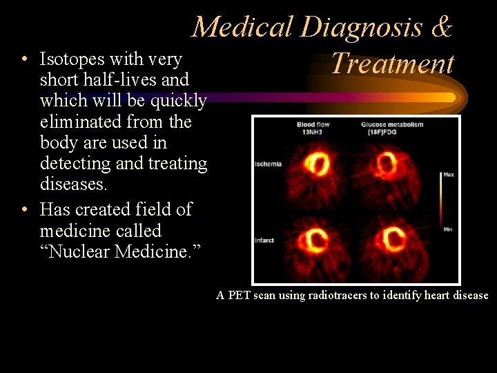  • Medical Diagnosis & Isotopes with very Treatment short half-lives and which will