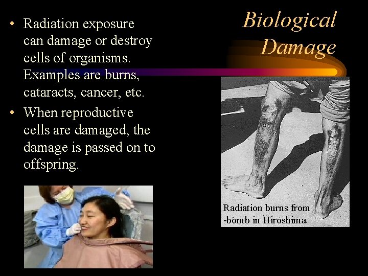  • Radiation exposure can damage or destroy cells of organisms. Examples are burns,