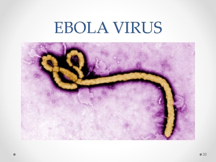 EBOLA VIRUS 30 EBOLA VIRUS 30