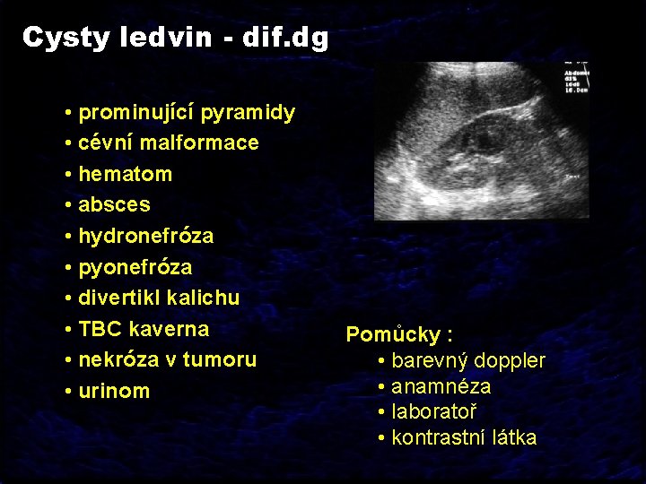 Cysty ledvin - dif. dg • prominující pyramidy • cévní malformace • hematom •