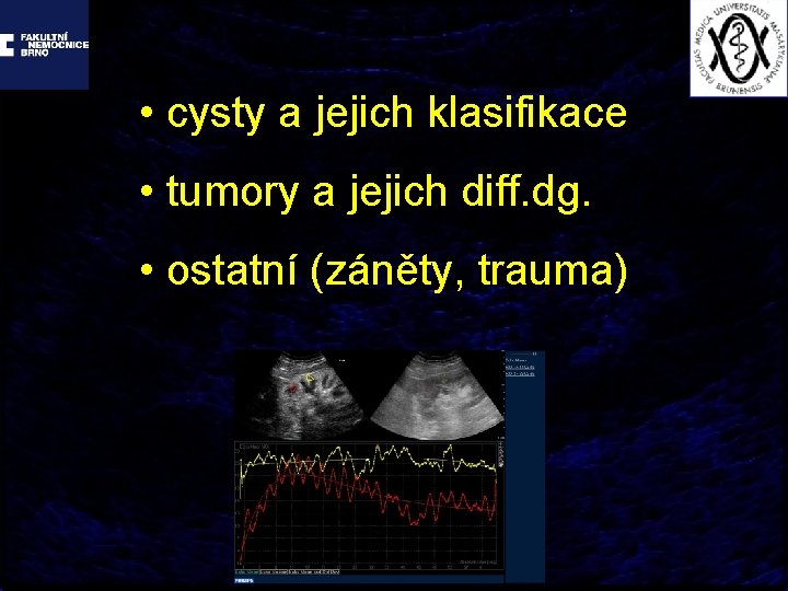  • cysty a jejich klasifikace • tumory a jejich diff. dg. • ostatní