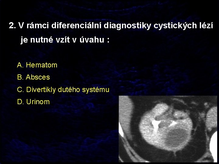 2. V rámci diferenciální diagnostiky cystických lézí je nutné vzít v úvahu : A.