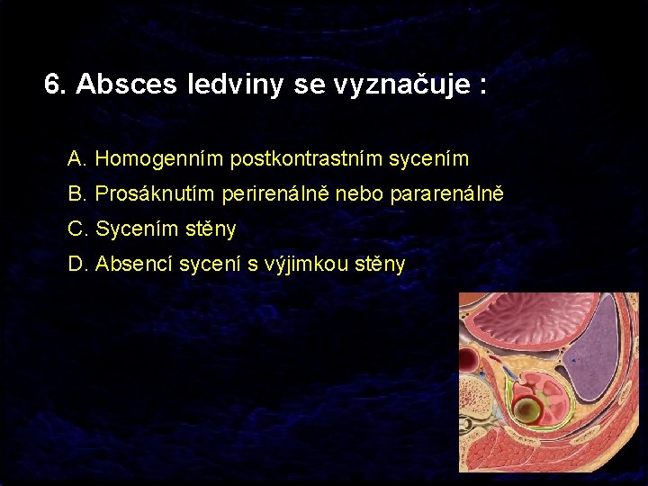 6. Absces ledviny se vyznačuje : A. Homogenním postkontrastním sycením B. Prosáknutím perirenálně nebo