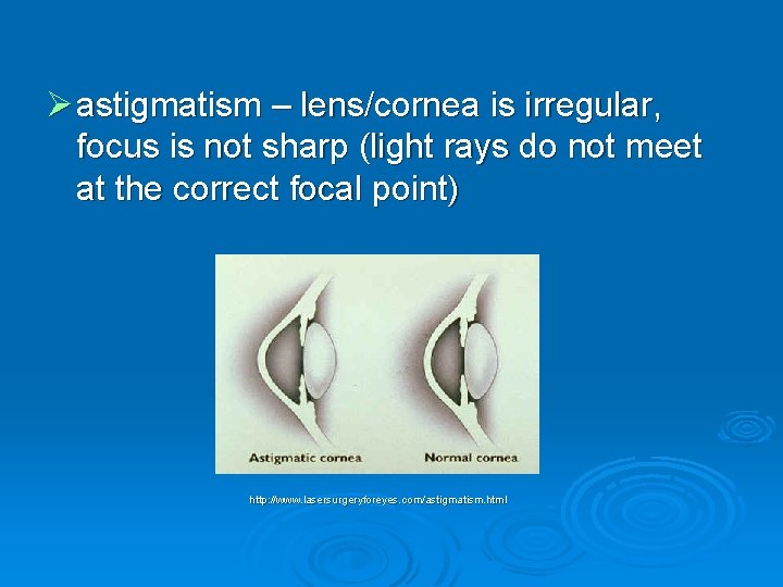 Ø astigmatism – lens/cornea is irregular, focus is not sharp (light rays do not