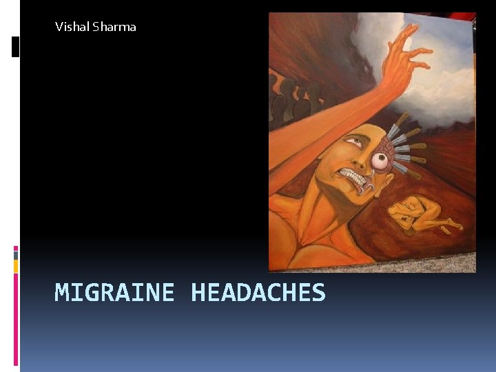 Vishal Sharma MIGRAINE HEADACHES 