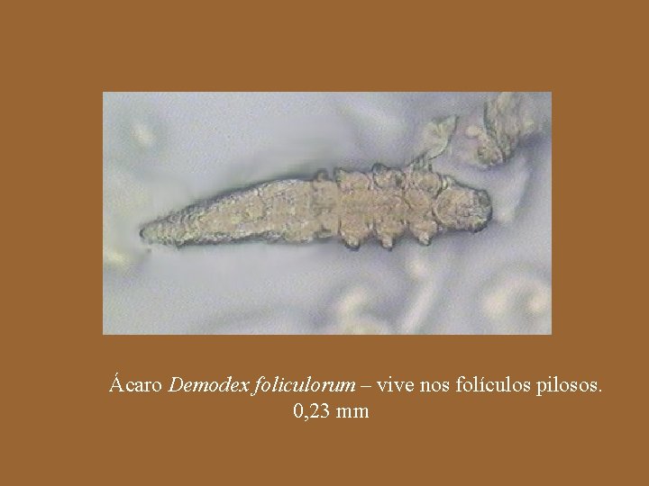 Ácaro Demodex foliculorum – vive nos folículos pilosos. 0, 23 mm 