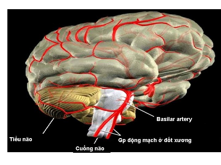 Basilar artery Tiểu não Gp động mạch ở đốt xương Cuống não 