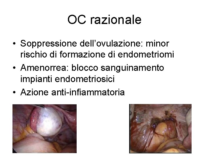 OC razionale • Soppressione dell’ovulazione: minor rischio di formazione di endometriomi • Amenorrea: blocco