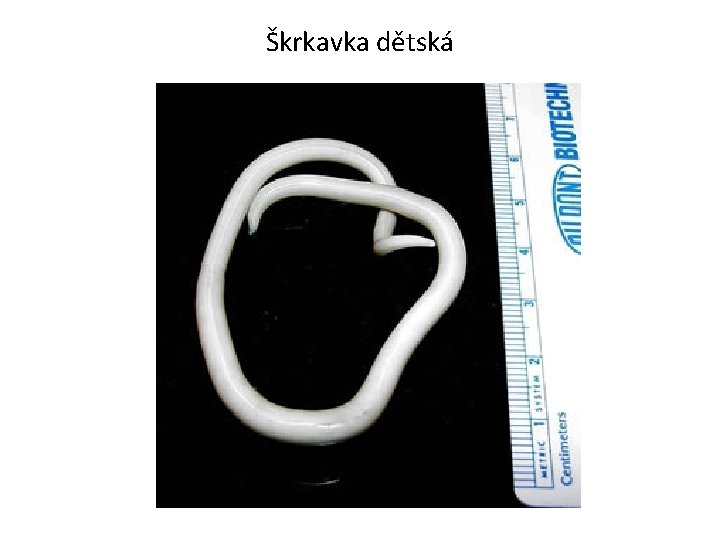 Škrkavka dětská Škrkavka dětská