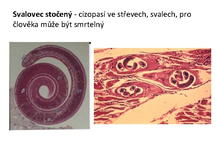 Svalovec stočený - cizopasí ve střevech, svalech, pro člověka může být smrtelný Svalovec stočený - cizopasí ve střevech, svalech, pro člověka může být smrtelný