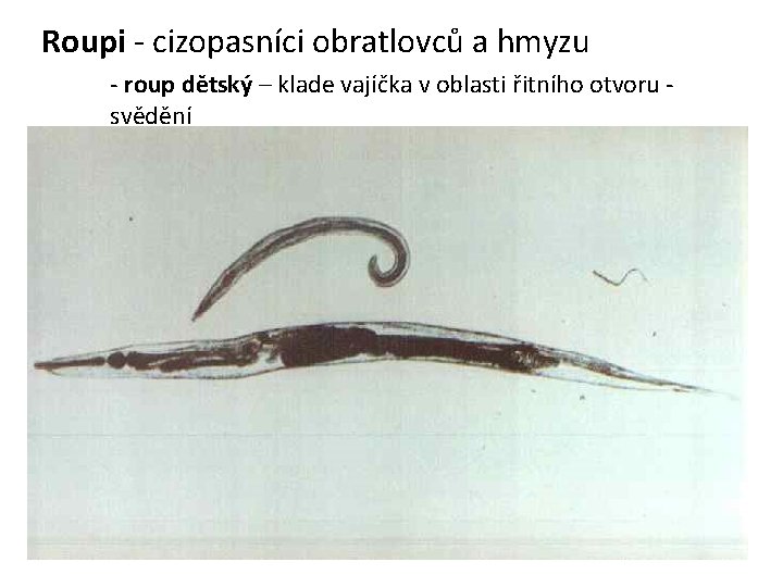 Roupi - cizopasníci obratlovců a hmyzu - roup dětský – klade vajíčka v oblasti Roupi - cizopasníci obratlovců a hmyzu - roup dětský – klade vajíčka v oblasti