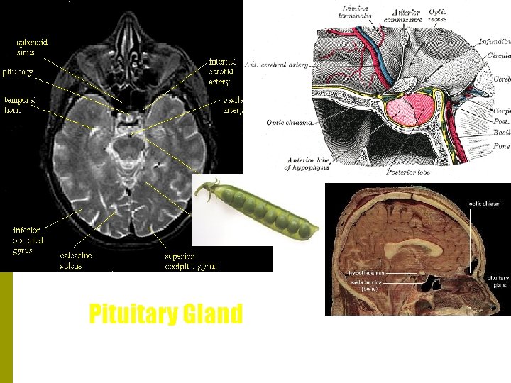 Pituitary Gland 