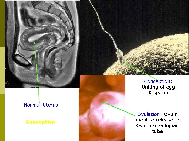 Conception: Uniting of egg & sperm Normal Uterus Conception Ovulation: Ovum about to release
