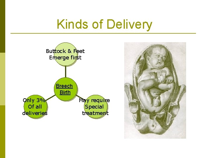 Kinds of Delivery Buttock & Feet Emerge first Breech Birth Only 3% Of all