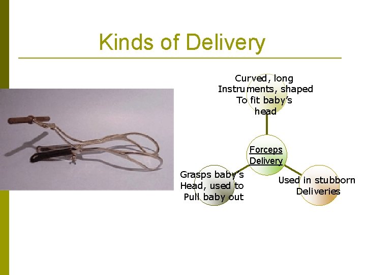 Kinds of Delivery Curved, long Instruments, shaped To fit baby’s head Forceps Delivery Grasps