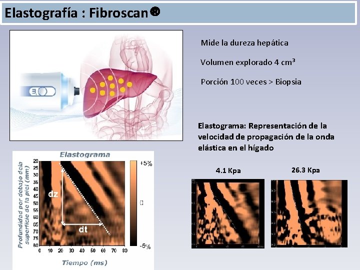 Elastografía : Fibroscan® Mide la dureza hepática Volumen explorado 4 cm³ Porción 100 veces