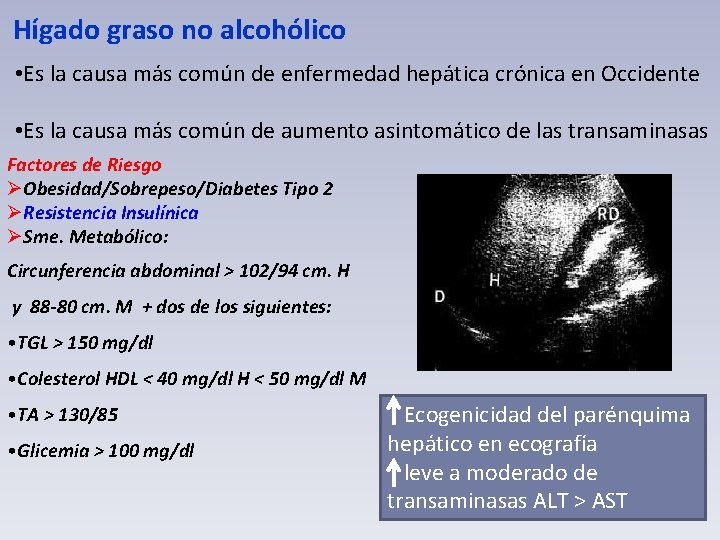 Hígado graso no alcohólico • Es la causa más común de enfermedad hepática crónica