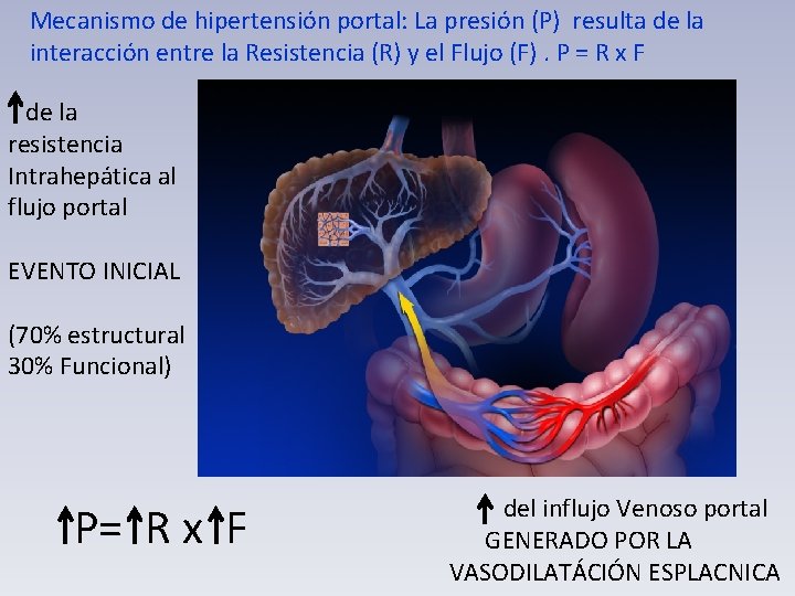 Mecanismo de hipertensión portal: La presión (P) resulta de la interacción entre la Resistencia