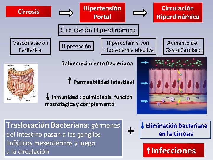 Hipertensión Portal Cirrosis Circulación Hiperdinámica Vasodilatación Periférica Hipotensión Hipervolemia con Hipovolemia efectiva Aumento del