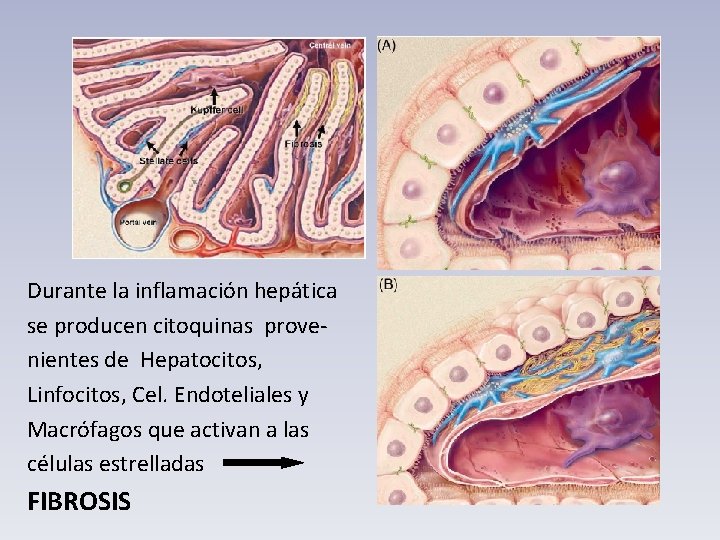Durante la inflamación hepática se producen citoquinas provenientes de Hepatocitos, Linfocitos, Cel. Endoteliales y
