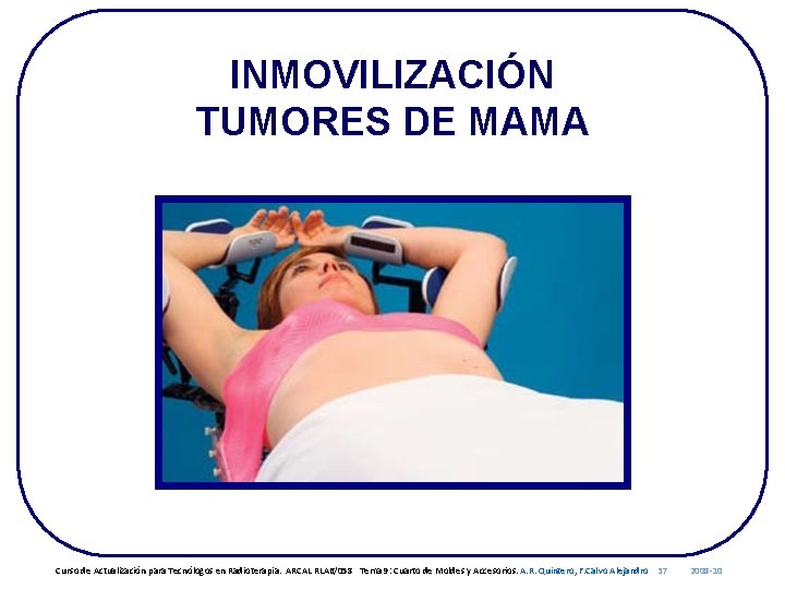 INMOVILIZACIÓN TUMORES DE MAMA Curso de Actualización para Tecnólogos en Radioterapia. ARCAL RLA 6/058