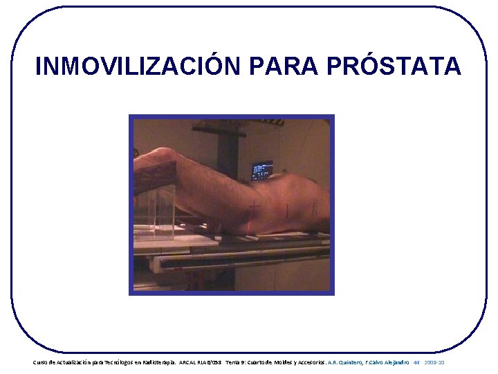 INMOVILIZACIÓN PARA PRÓSTATA Curso de Actualización para Tecnólogos en Radioterapia. ARCAL RLA 6/058 Tema