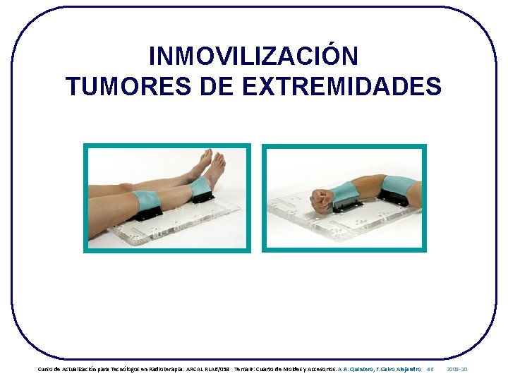 INMOVILIZACIÓN TUMORES DE EXTREMIDADES Curso de Actualización para Tecnólogos en Radioterapia. ARCAL RLA 6/058