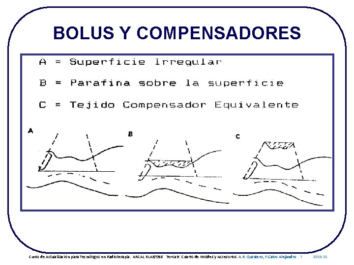 BOLUS Y COMPENSADORES Curso de Actualización para Tecnólogos en Radioterapia. ARCAL RLA 6/058 Tema